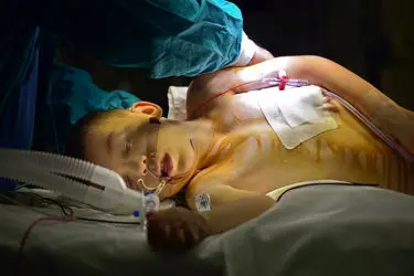Gentle-Violence-The-Heart-Memories-from-the-darkness-of-our-bodies9__880
