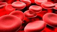 کدام بیماری‌ها و مشکلات را می‌توان با فصد خون درمان کرد؟