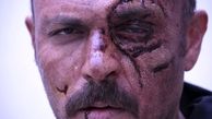 وقتی چشم بازیگر شاه کش کنده میشود+عکس