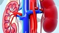 چگونه کلیه های سالم داشته باشیم؟