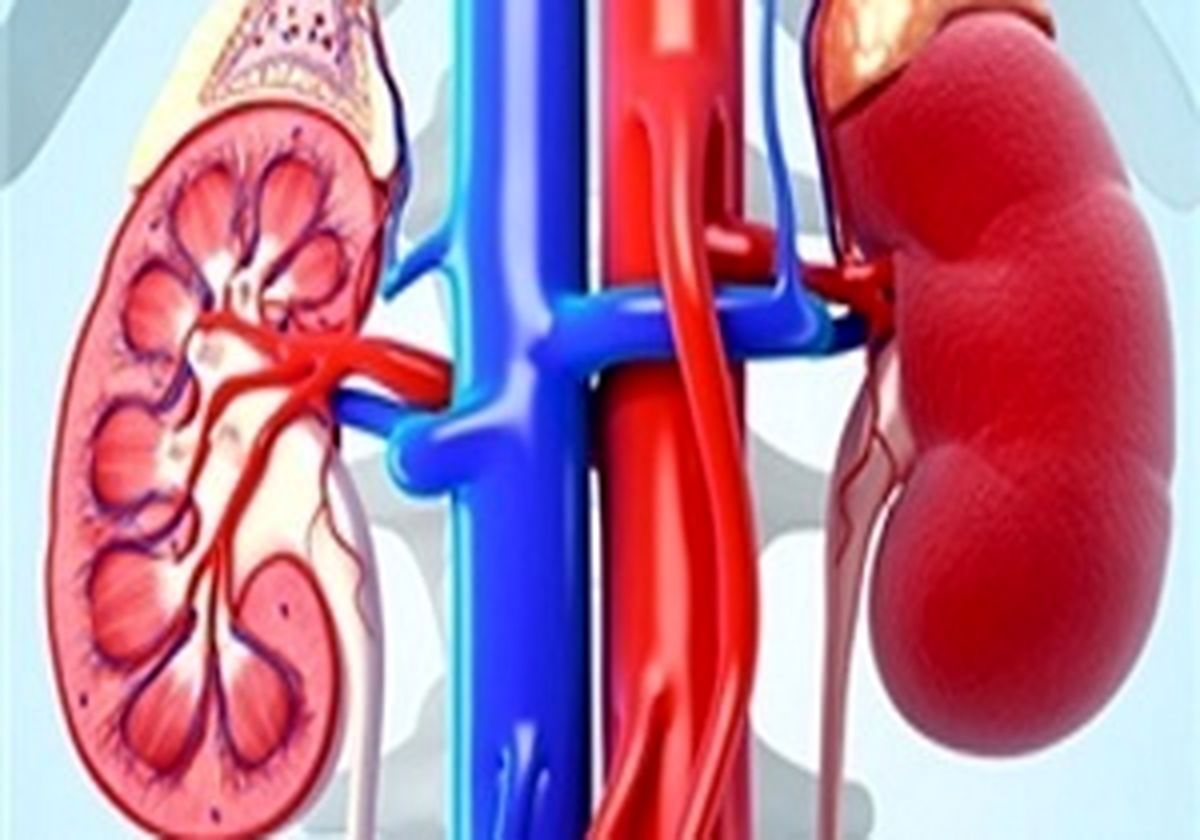 چگونه کلیه های سالم داشته باشیم؟