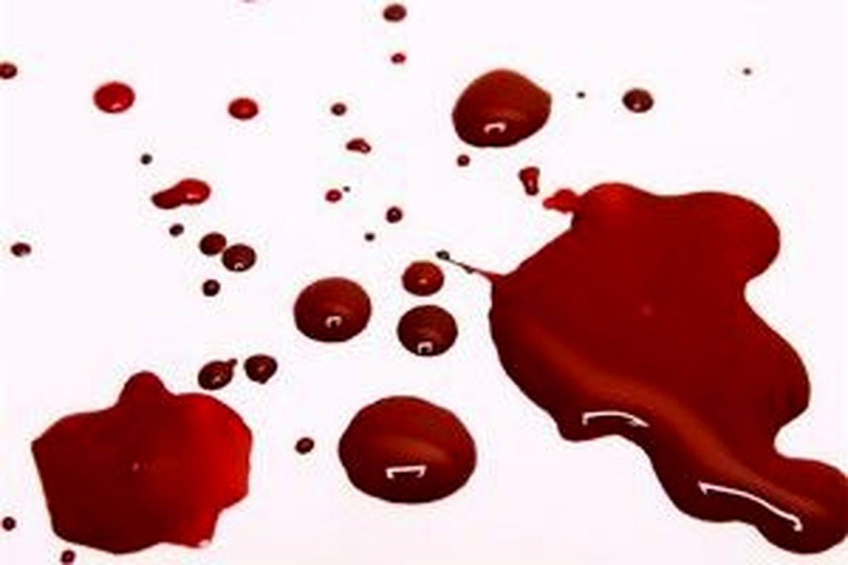 چه افرادی در معرض لخته شدن خون هستند