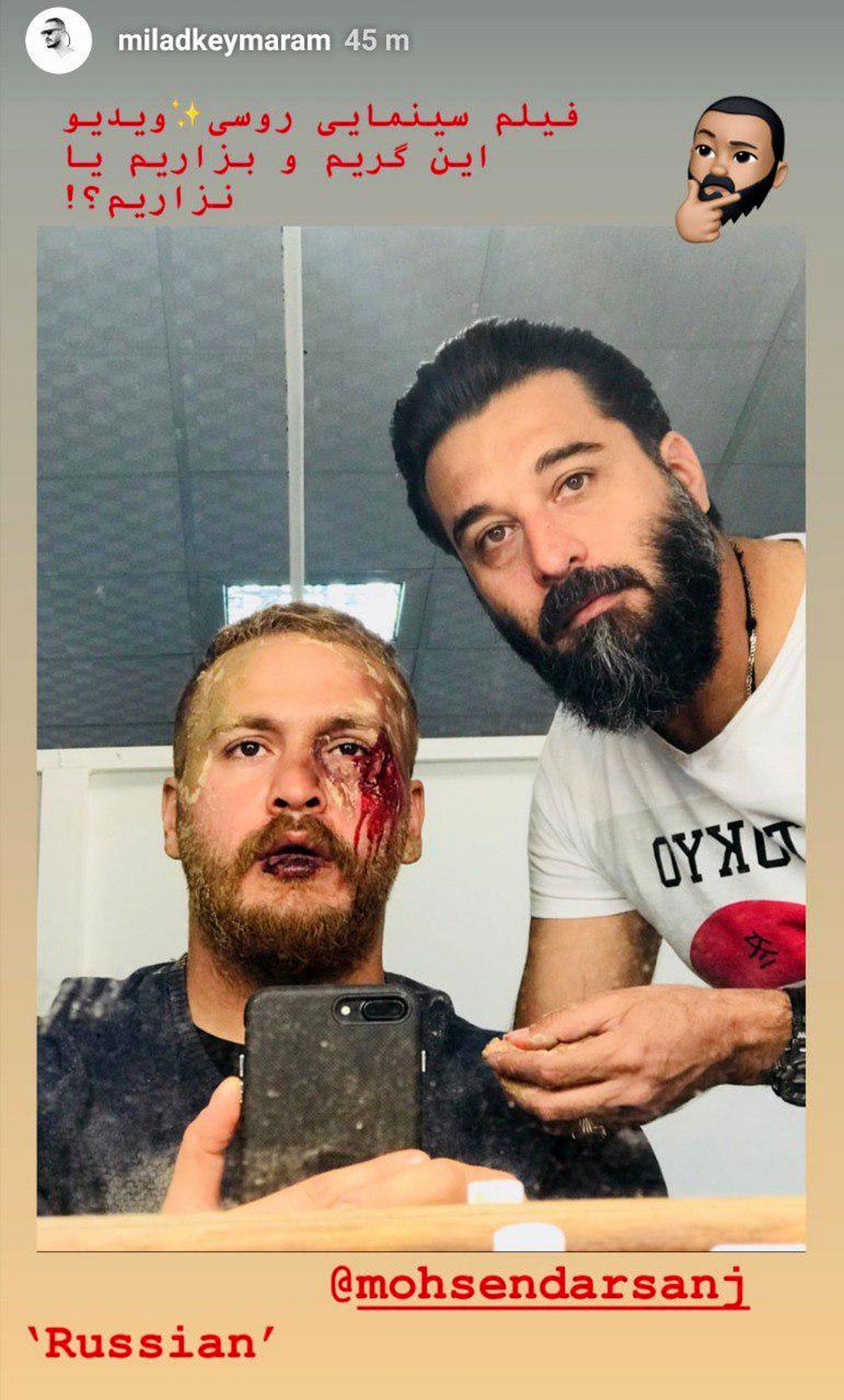صورت آسیب دیده میلاد کی مرام+عکس