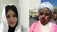 بررسی طرح تشدید مجازات اسیدپاشی