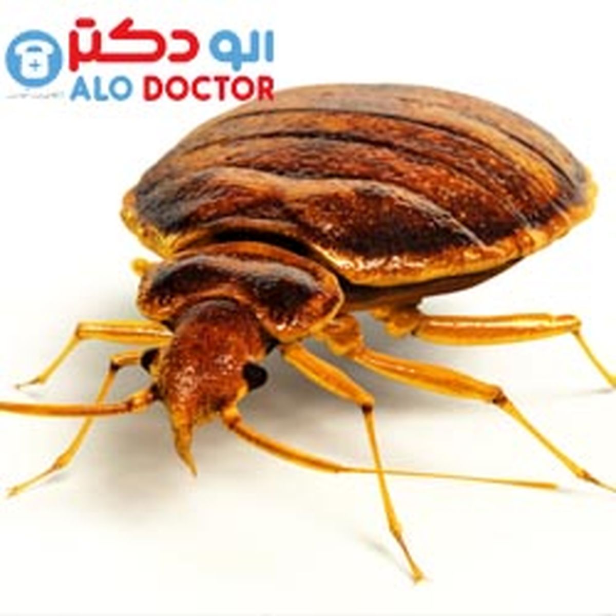 این نشانه ها یعنی ساس مهمان خانه تان شده است
