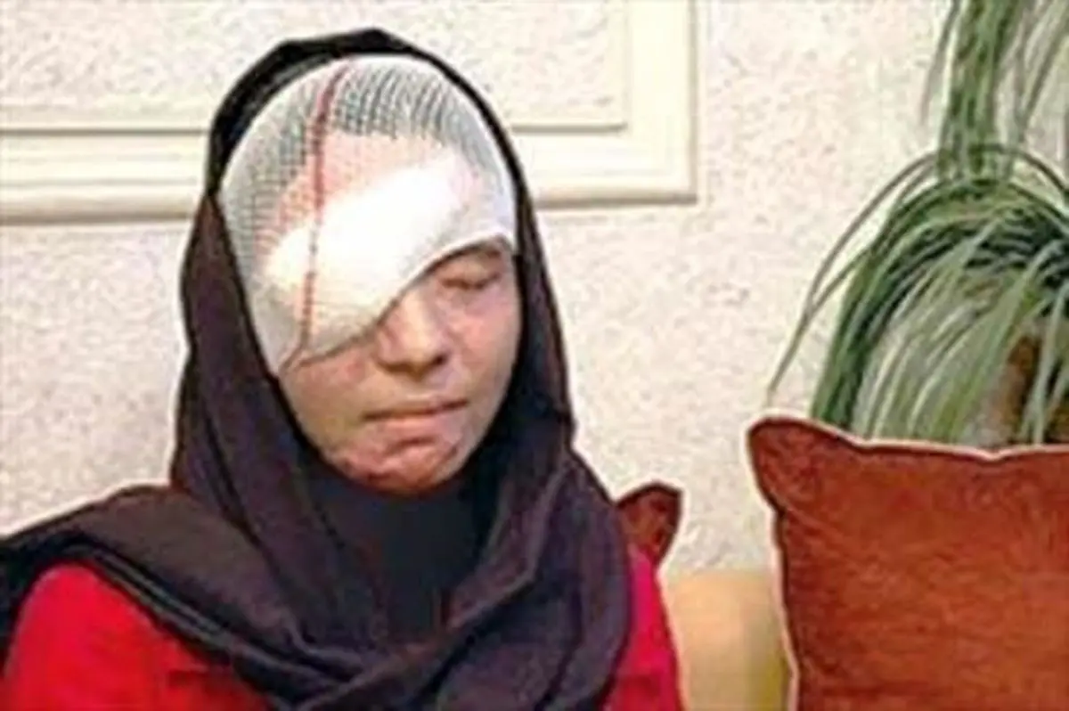 محاکمه مجدد پدرشوهر اسیدپاش