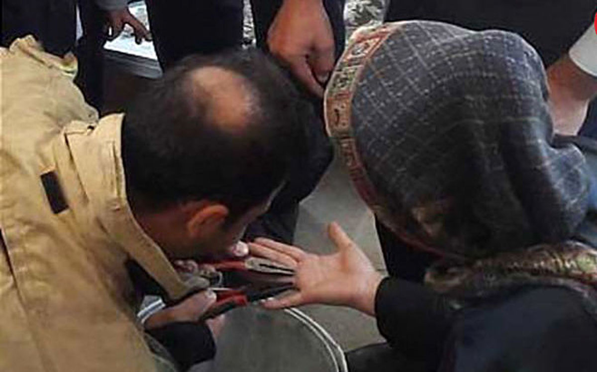 انگشتر تنگ دردسرساز شد 
