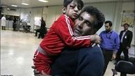 ترقه بازی پسر بازیگوش حادثه ساز شد