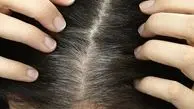 ماسک ماست و تخم مرغ روشی مناسب برای سلامت موی سر