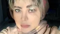 زخمی شدن خانم بازیگر در یک درگیری + عکس