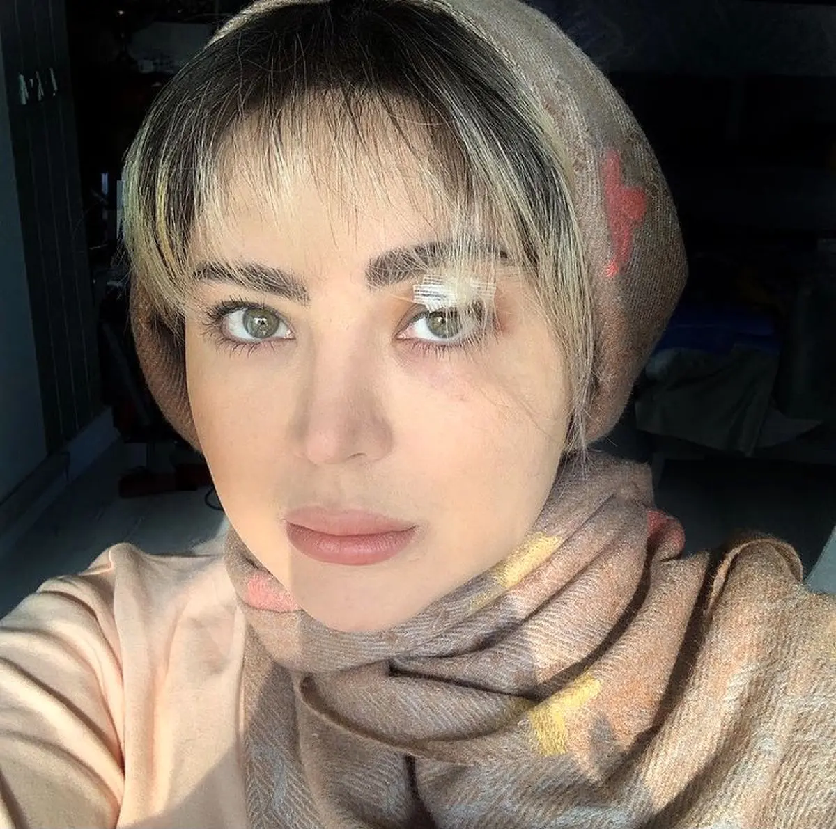 زخمی شدن خانم بازیگر در یک درگیری + عکس