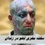 سکته مغزی تتلو تکذیب شد !