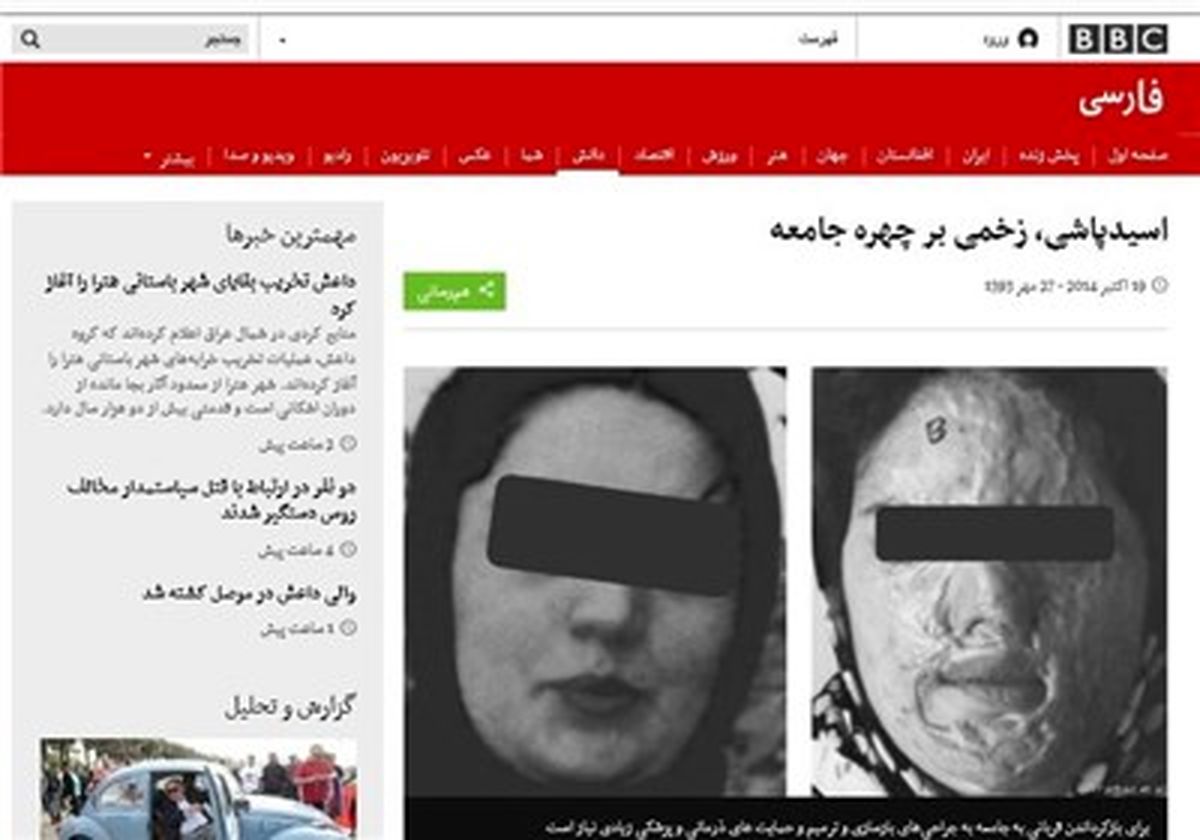 قصاص اسیدپاشی در بی‌‌بی‌سی دیروز و امروز