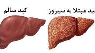 9 علامت بیمار شدن کبد