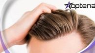 با جدیدترین روش های کاشت مو در دنیا آشنا شوید!【سال ۱۴۰۲】