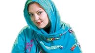 انتقاد تند بازیگر زن از سونامی جراحی زیبایی