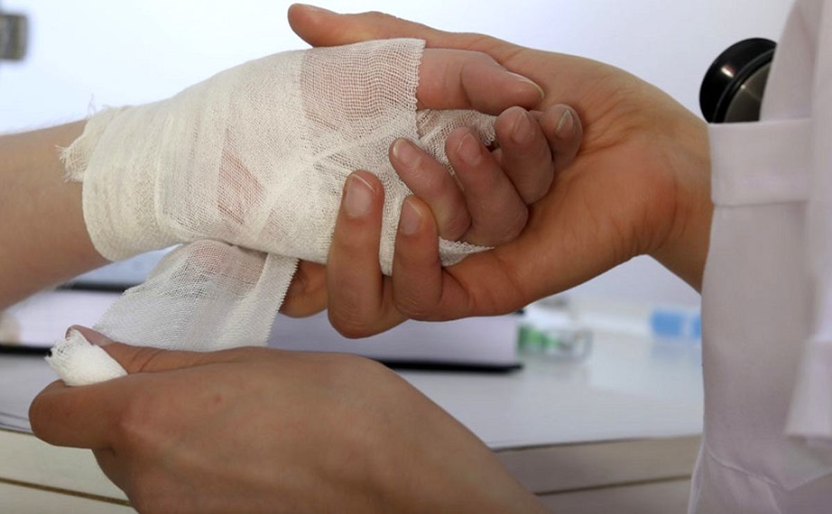 چگونه تاول ناشی از سوختگی را در کمترین زمان درمان کنیم؟