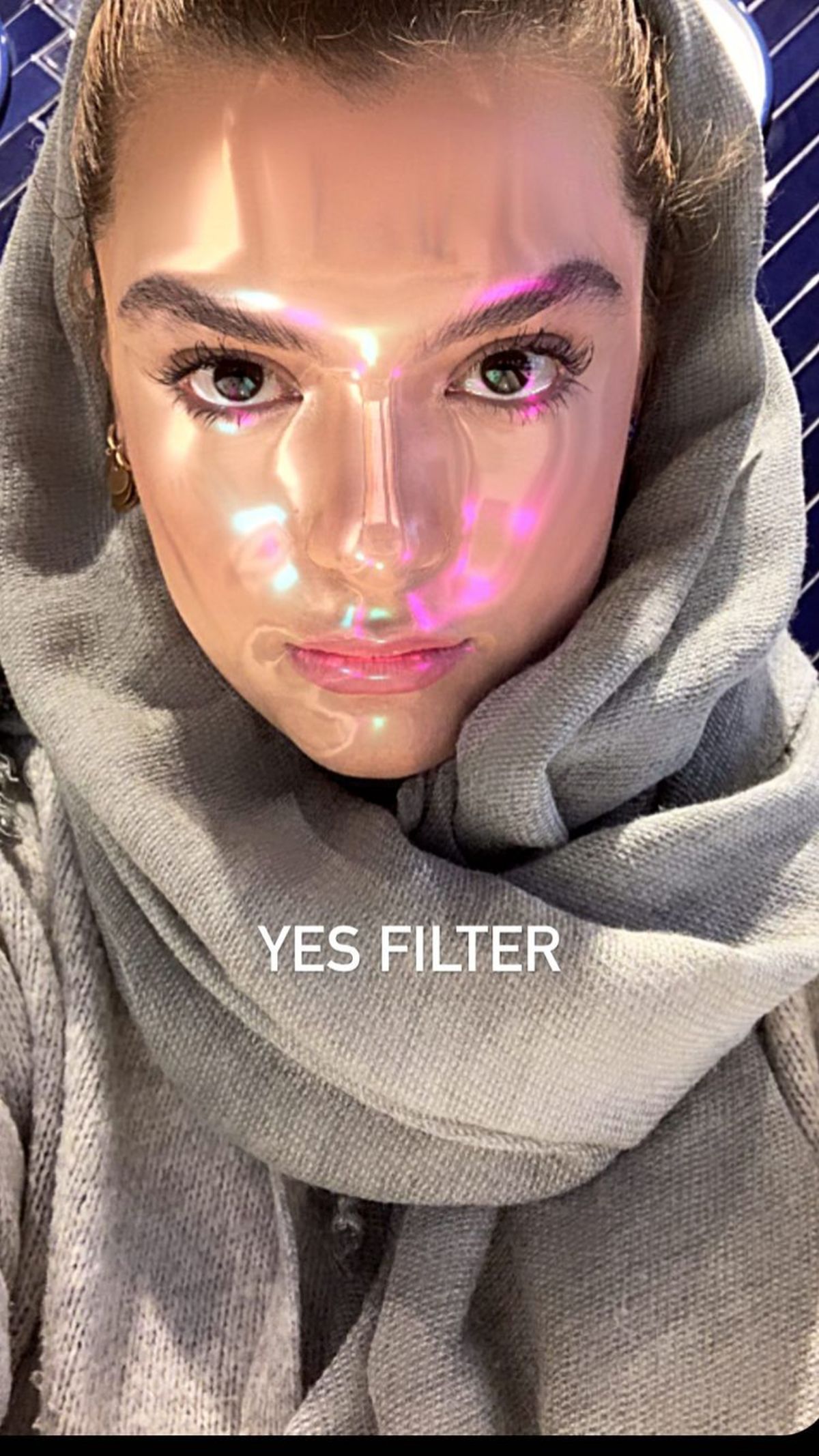 صورت دنیا مدنی چی شده ؟ + عکس