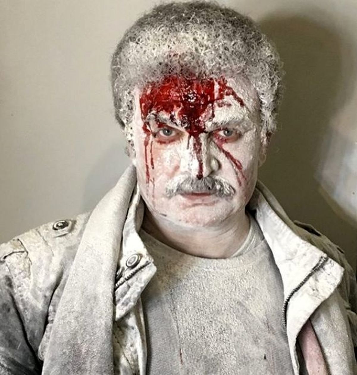 مهدی سلطانی با صورتی زخمی + عکس