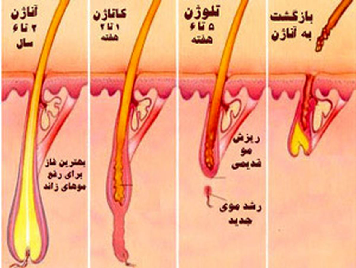 خلاص شدن از شر موهای زائد بدن
