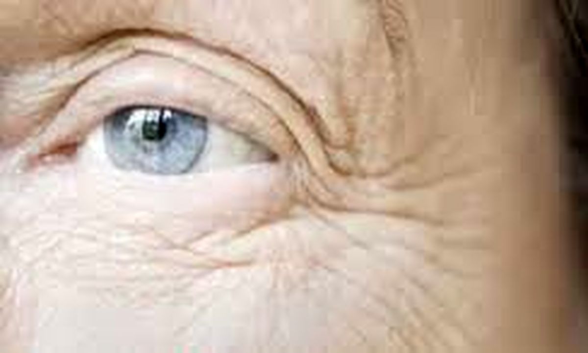 نکاتی طلایی برای رهایی از چین و چروک اطراف چشم 