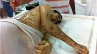 شکنجه در بحرین سازمان یافته است