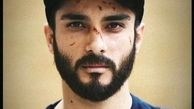صورت پر از زخم ساعد سهیلی + عکس
