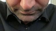 خشم مهدی کوشکی + عکس