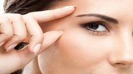 رکورد دارهای عمل های زیبایی!