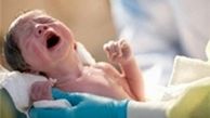 افزایش آمار سزارین در تاریخ‌های خاص سال