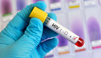 درمان موفق HIV در آستانه آزمایشات انسانی