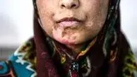 سرانجام وضعیت نگهداری «اعظم» چه می شود؟ 