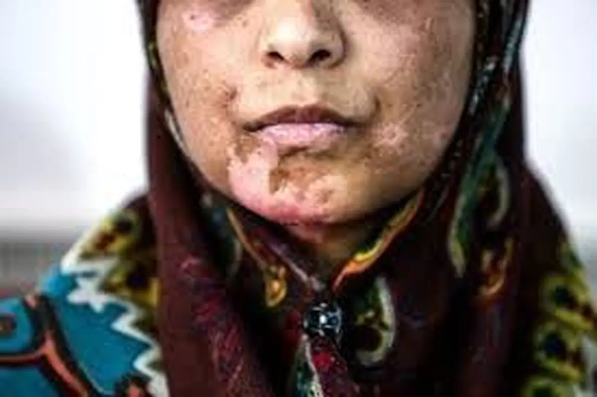 سرانجام وضعیت نگهداری «اعظم» چه می شود؟ 