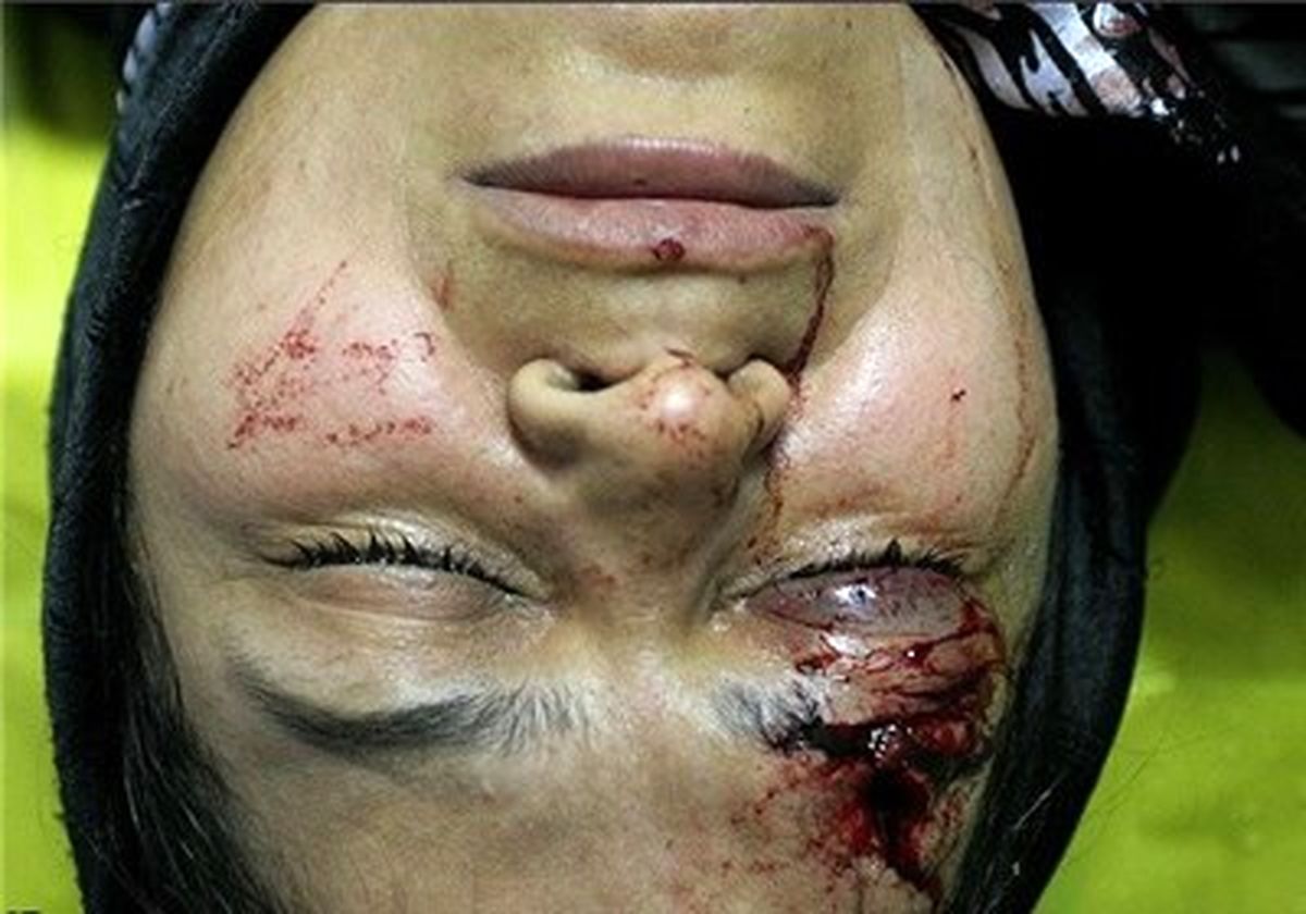 تعداد مجروحان چهارشنبه پایان سال کشور به ۱۴۸ نفر افزایش یافت