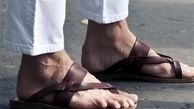 پوشیدن «صندل» برای دیابتی‌ها ممنوع