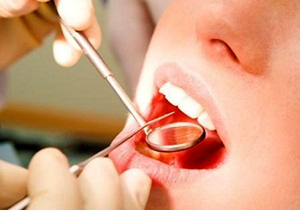 احتمال ابتلا به ایدز و هپاتیت بر اثر سهل انگاری در دندانپزشکی 