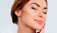 لیفت صورت با نخ چگونه انجام می‌شود و چه مزایا و عوارضی دارد ؟