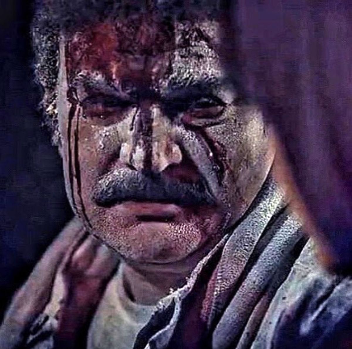 صورت خونی مهدی سلطانی + عکس