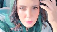 صورت آفتاب خورده لیلا بلوکات + عکس