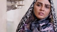 صورت زخمی خانم‌ بازیگر جوان + عکس