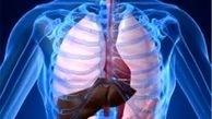 خطرات اضافه وزن را جدی بگیرید