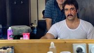 عکس از صورت چنگ خورده پوریا پورسرخ