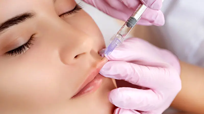 پزشک تزریق ژل لب روسی در شیراز