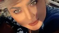 تغییر چهره سولماز آقمقامی + عکس