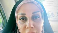 گریم متفاوتی از شیوا خسرومهر در دادستان + عکس