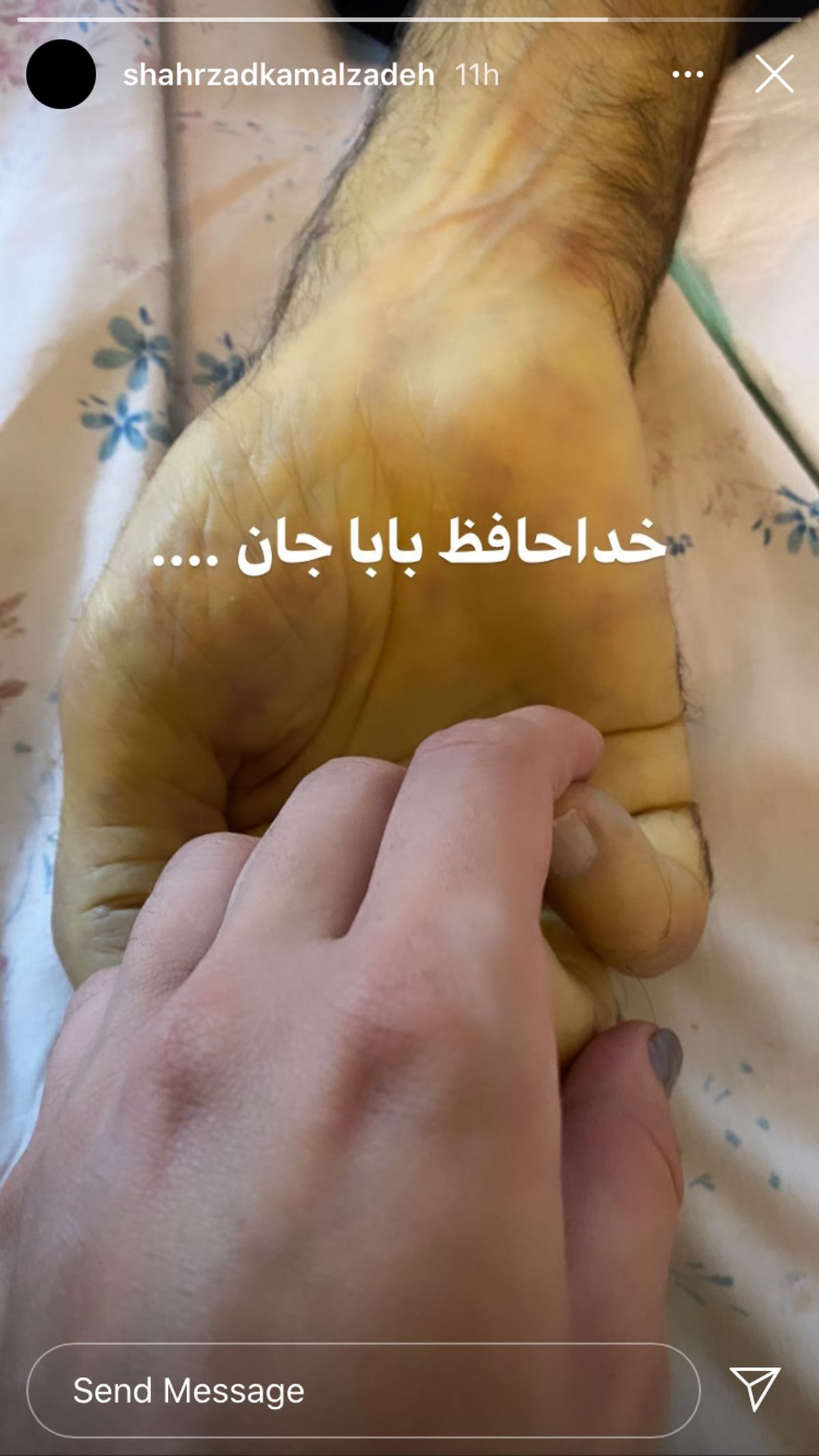 بازیگر معروف  داغدار شد + عکس