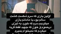 امیرمهدی ژوله با سری شکسته + عکس