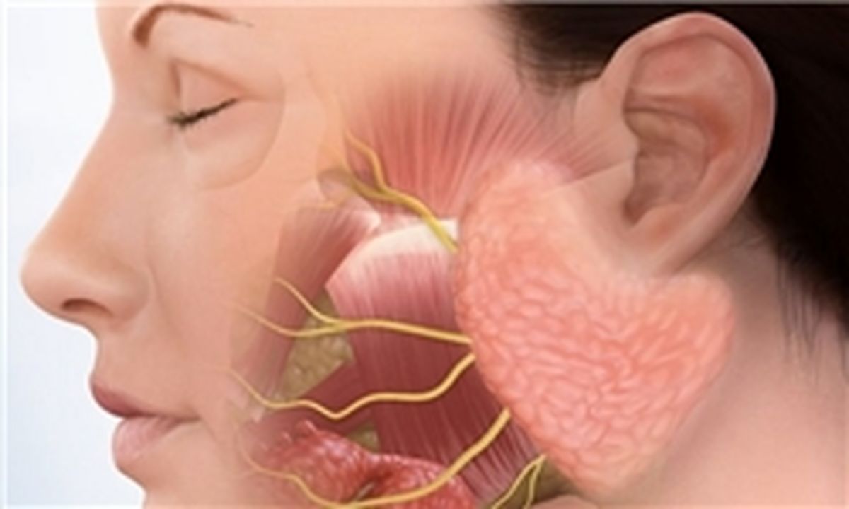 علائم تومور غدد بزاقی چیست؟