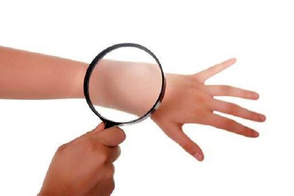 راه های جلوگیری از خارش پوست در زمستان