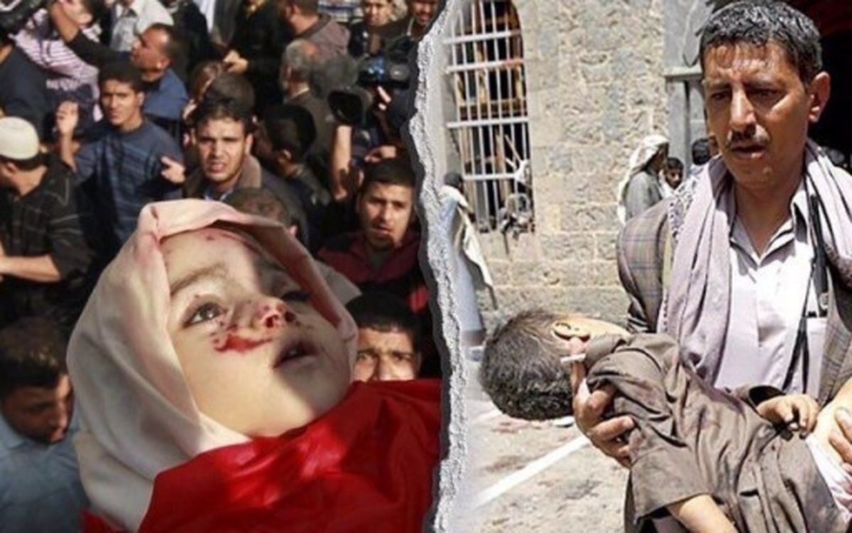 سهم ديپلماسي در بحران يمن